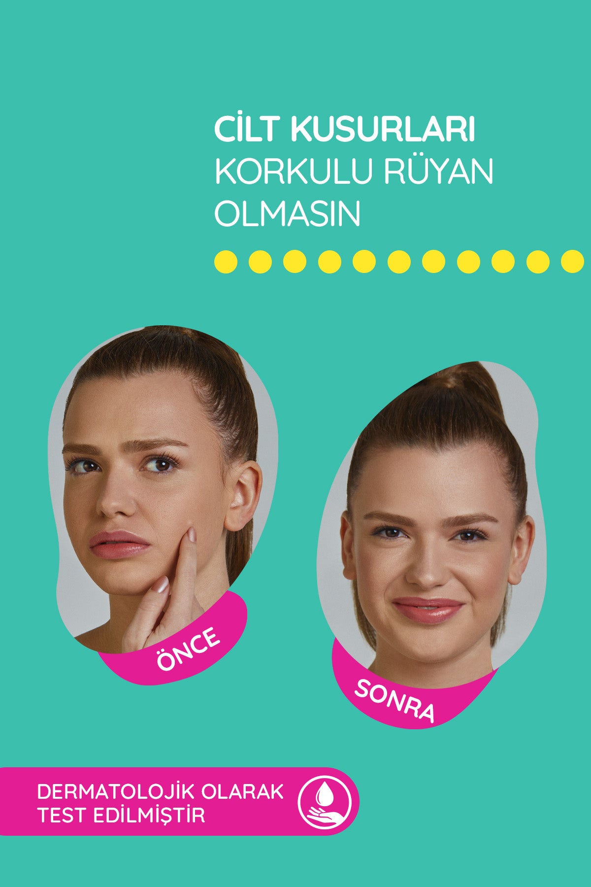 SOS Band Original (15’li) & Maxi (6’lı) %100 Hidrokolloid Sivilce/Akne Bandı