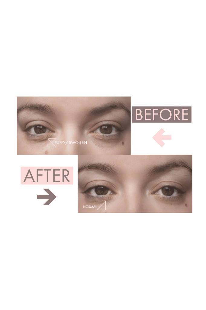 eyewake Yaşlandırma Karşıtı Göz Çevresi Bakım Jeli