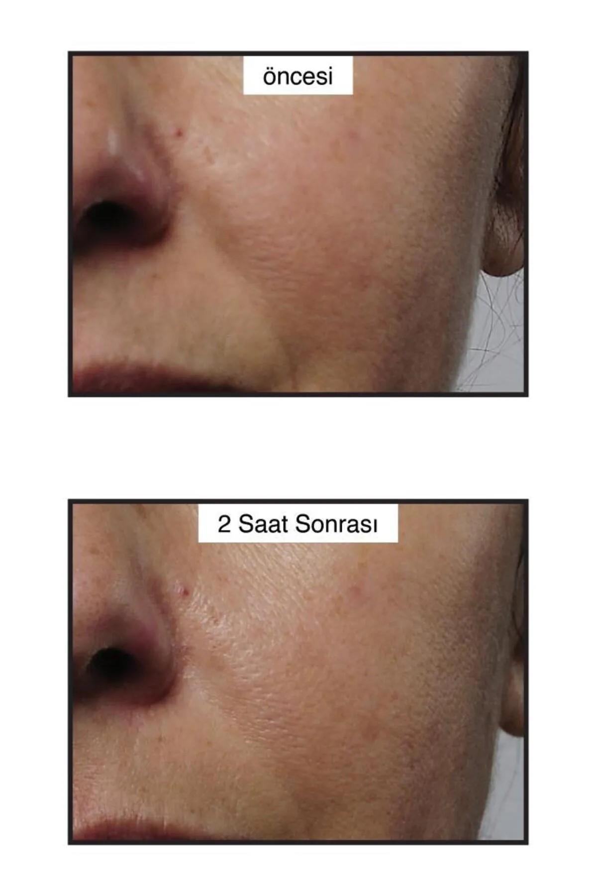 Rapid Collagen Infusion – Anında Sıkılaştırıcı Kolajen Serumu 30 ML