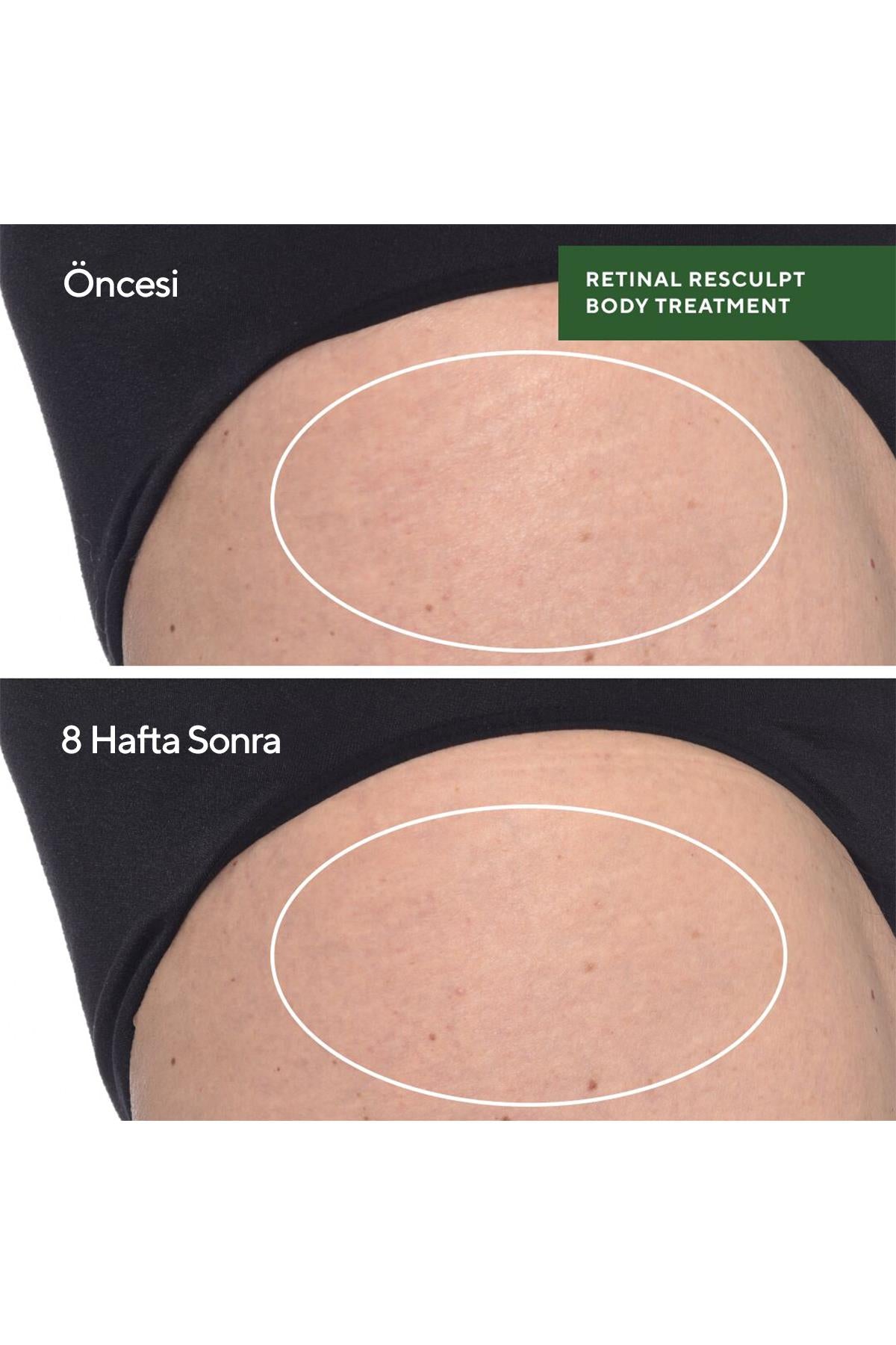 Retinal Resculpt Body Treatment - Retinal İçeren Yenileyici Vücut Bakımı 150ML