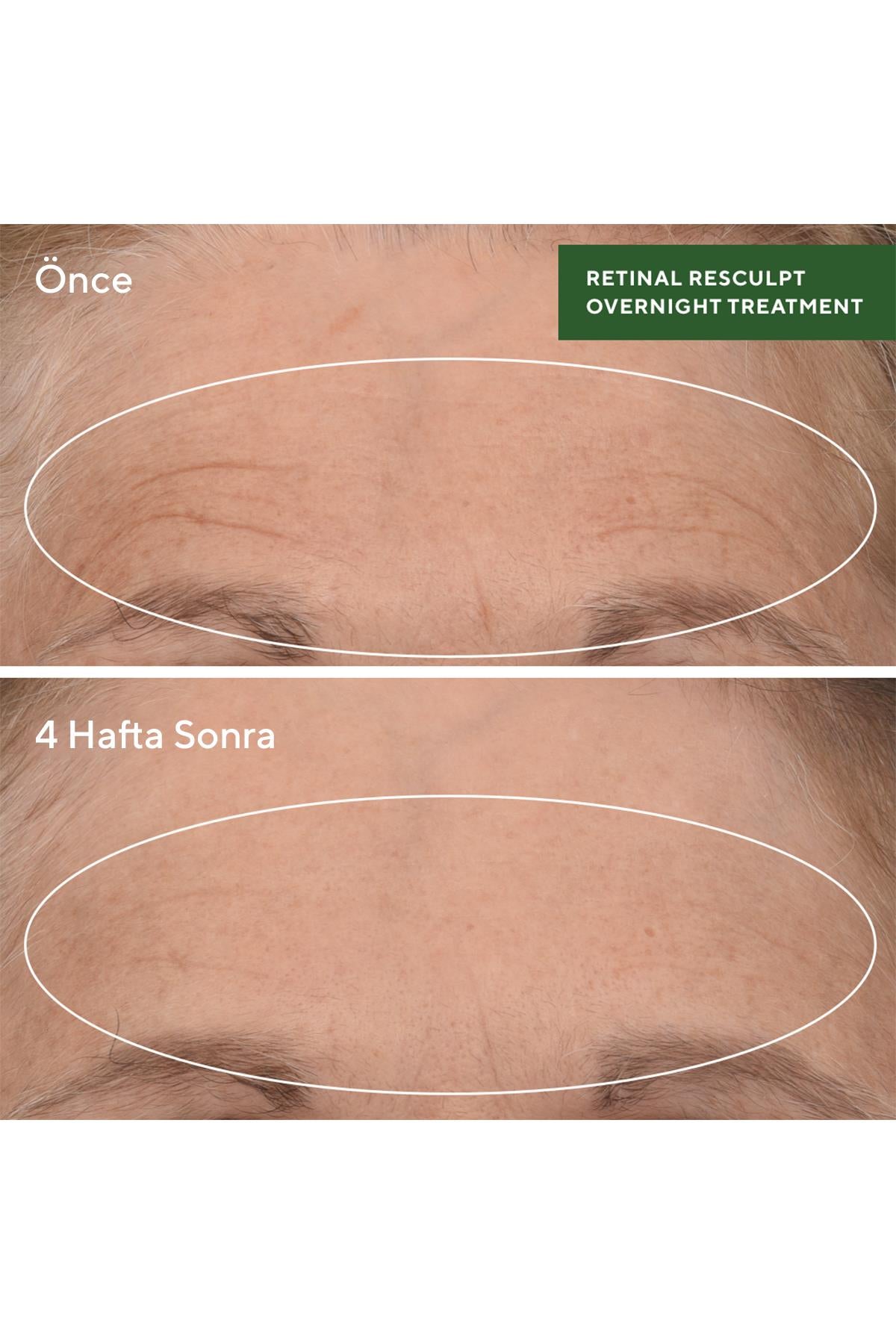 Retinal Resculpt Overnight Treatment - Retinal İçeren Yenileyici Mucize Gece Serumu 30 ML