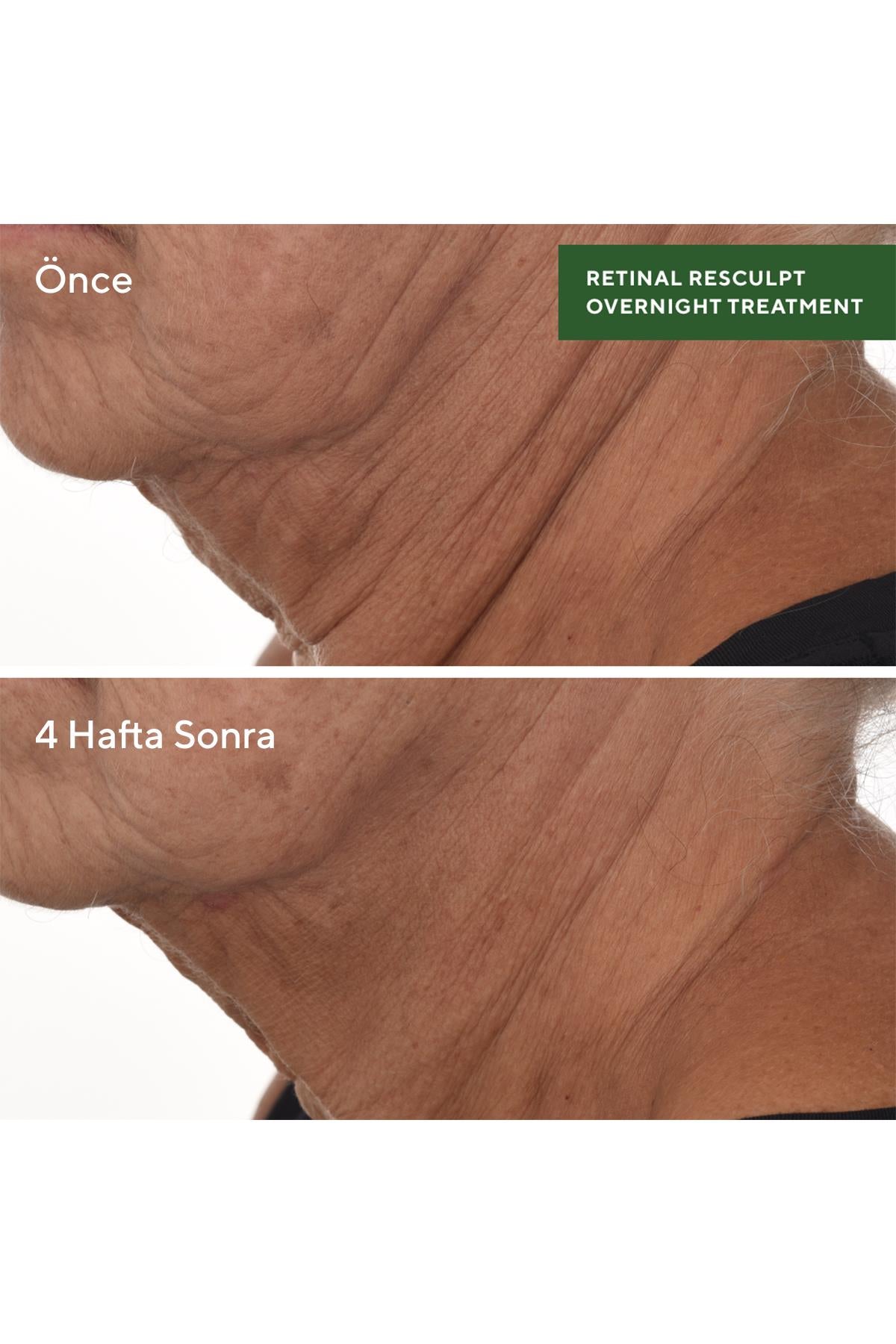Retinal Resculpt Overnight Treatment - Retinal İçeren Yenileyici Mucize Gece Serumu 30 ML
